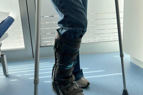 Attelle sur jambe gauche au service de chirugie orthopédique du Centre médical Gare de Vevey