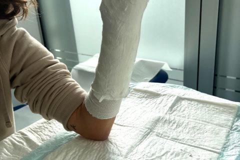 Cast on the right arm at the orthopedic surgery department of the Centre médical Gare de Vevey